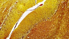 Human cerebellum filmed under microscope with 200x magnification on white background. Isolated macro footage of the brain part pattern responsible for coordination and muscle tone of people organism - Powered by Shutterstock - Get 15% off with code: PIKWIZARD15