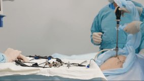 Surgeons team during process operation gallbladder removal with surgical laparoscopy instruments. Laparoscopic cholecystectomy tools. Real Surgery, abdominal incision, modern surgery. 4 k video