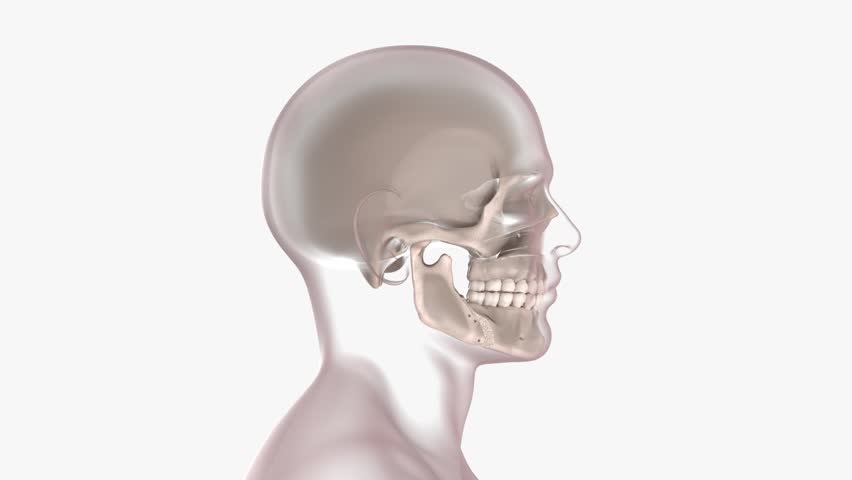 3d animation of orthognathic surgery