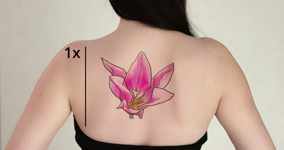 Laser Tattoo Removal On Woman's Back Against White Background Royalty-Free Stock Footage #1098840141