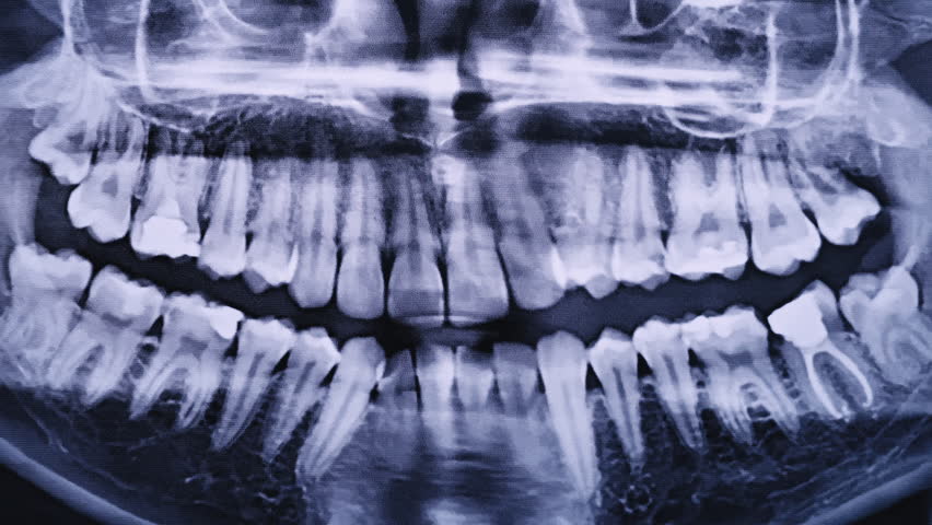 X-ray image of the jaw of all human teeth close-up. Magnetic resonance imaging of teeth. The doctor examines the x-ray of the tooth. Health care and medicine, dentistry, dentistry concept.