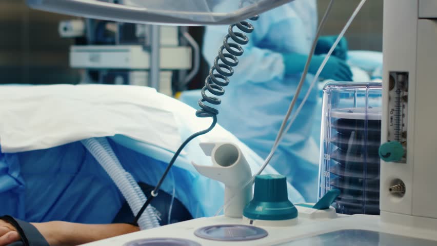 Close-up of artificial lung ventilation of a patient in the operating room. High quality 4k footage | Shutterstock HD Video #1099081289