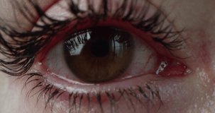 Close-up of the opening of the eyes with brown iris, all red with inflamed protein from long work at the computer. The concept of unhealthy vision. Macro video in front in 4K.