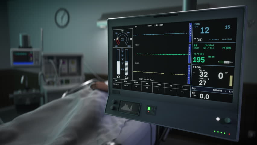 Clinic Equipment For Medical Monitoring Detects Decrease Of Life Signs. Clinic Equipment Displays Life Parameters. Clinic Equipment Checks Heart Rate And Breathing Of Patient. Falling Life Parameters | Shutterstock HD Video #1099196601
