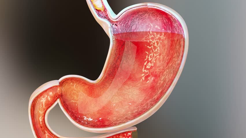 Stomach Acid Relux. Esophagus,  gerd. Pain In The Digestive System, Gastritis, pyrosis, human body organ, 3d render | Shutterstock HD Video #1099248543