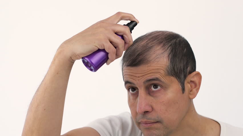 Young man hair treatment. Male person who applies a product to stop hair loss. Therapy with lotion in liquid cosmetic spray. | Shutterstock HD Video #1099268415