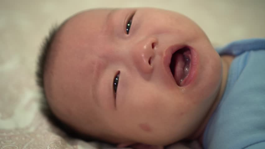 Close up infant face crying at bed. Face with red itchy dot bitten by mosquito