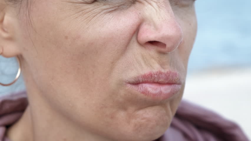 Pain from herpes. The female touches her sore lips affected by the herpes virus. | Shutterstock HD Video #1099419145