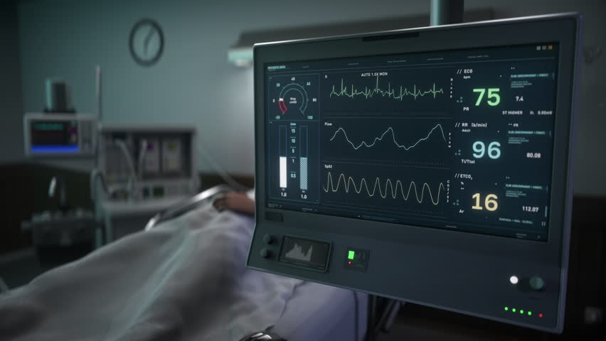 Hospital Respiratory Support Machine Keeps Ill Patient Alive In Ward. Hospital Monitoring Machine. Artificial Respiratory Ventilation Maintains Life Signs. Hospital Machine Assists Respiratory System | Shutterstock HD Video #1099429891
