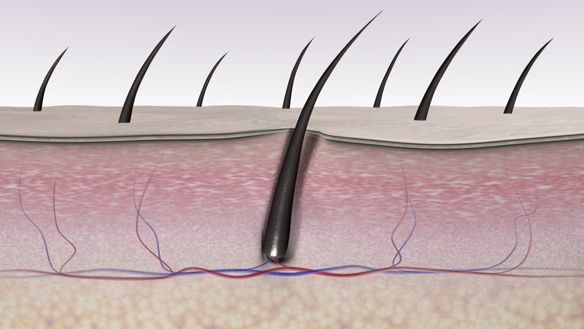 Hair removal by laser epilation method. Skin tissues cross-section.  Hair follicles before and after the action of the laser beam. 3d animation for advertising medical laser devices | Shutterstock HD Video #1099505249