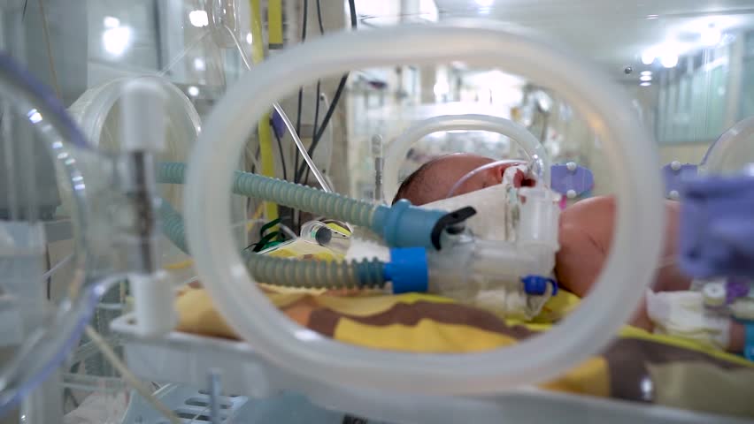 Closeup lovely little newborn baby infant lying in incubators for newborns, Newborn baby having the the breathing problem after birth, newborn in NICU, Neonatal intensive care unit. Royalty-Free Stock Footage #1099550445
