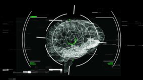 Animation of glitch effect and scope scanning over spinning human brain icon on black background. Medical research technology concept - Powered by Shutterstock - Get 15% off with code: PIKWIZARD15