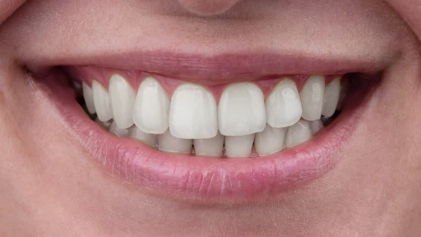Close-up of a woman's smile. White teeth gradually turn yellow. | Shutterstock HD Video #1099576411