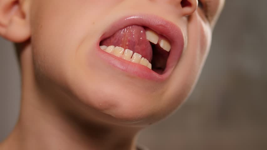 Close-up of a little boy's face with his mouth open, he shows his changing teeth. | Shutterstock HD Video #1099590445