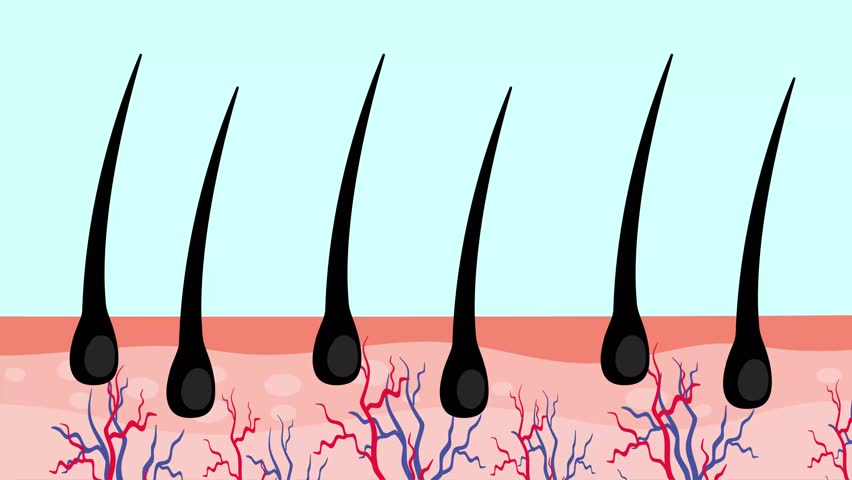 Hair loss proceeded by nutrient deficiency. 4K cartoon animation. | Shutterstock HD Video #1099612811