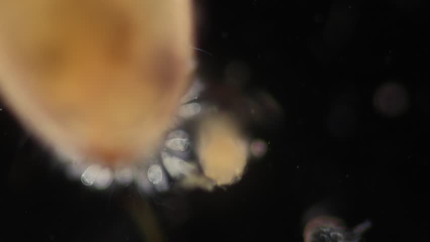 Protist in waste water under the microscope. | Shutterstock HD Video #1099653829