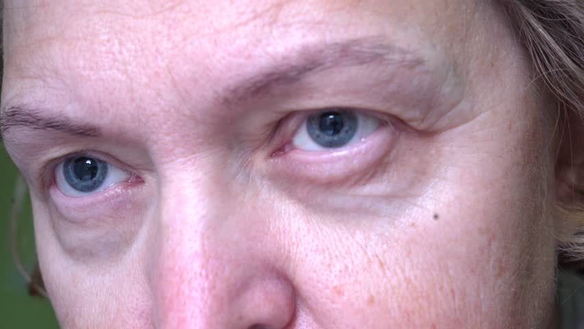 Middle-aged woman face with eye with dilated pupil, eyes treatment, hanging eyelid, closeup | Shutterstock HD Video #1099850047