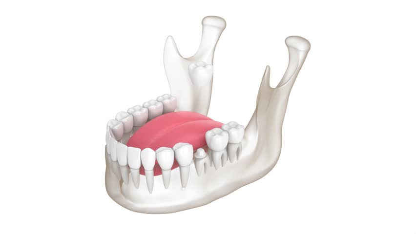Mandible with dental crown embed on reshaped tooth over white background, a Healthcare Video by Aleksandra Gigowska