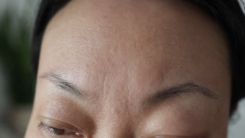 Close-up portrait of Asian woman displeased with wrinkles on her forehead. Sad girl points her finger at the signs of aging Royalty-Free Stock Footage #1100031817