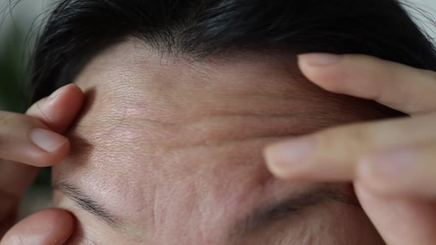 Close-up portrait of Asian woman displeased with wrinkles on her forehead. Sad girl points her finger at the signs of aging | Shutterstock HD Video #1100031817