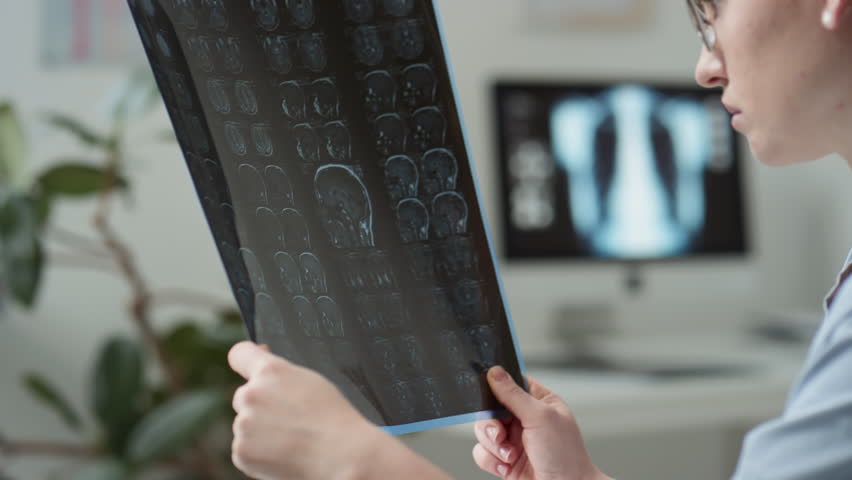 Close-up of young serious nurse or radiologist in medical scrubs holding brain scan of patient while looking at it attentively learning it in clinics before making ultimate diagnosis | Shutterstock HD Video #1100043223