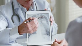 Senior Asian doctor showing lung x-ray test results and describe to a young woman patient in hospital. For cancer awareness month - Powered by Shutterstock - Get 15% off with code: PIKWIZARD15