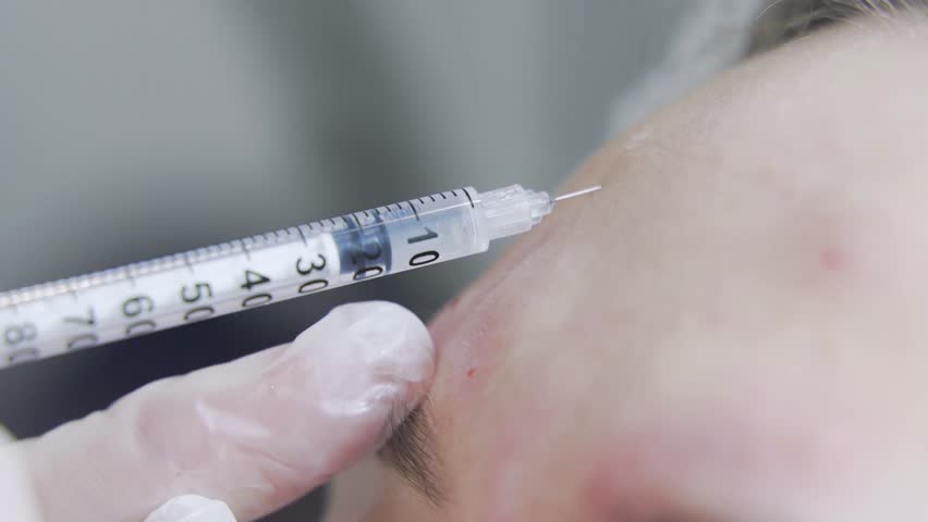 Beautician doctor makes botox injection in the forehead of young beauutiful wpman. Extreme close up 4k shot Royalty-Free Stock Footage #1100141511