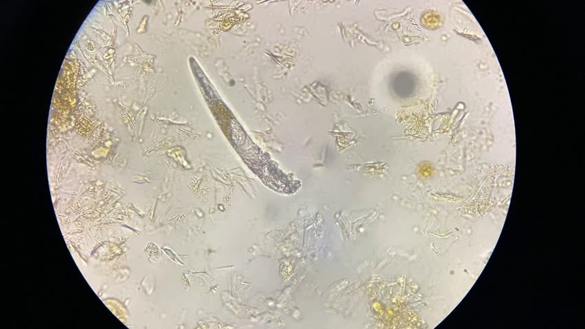 DEMODEX-CANIS Footage, Videos and Clips in HD and 4K - Avopix.com