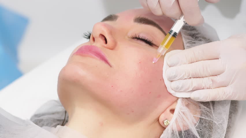 Cosmetologist is applying cream with anesthesia on patient's face skin before biorevitalization procedure. Woman in beauty clinic with doctor beautician preparing to treatment using numbing cream. Royalty-Free Stock Footage #1100252263