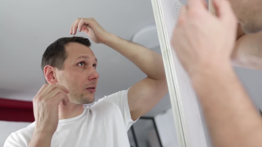 middle aged man with alopecia looking at mirror, hair loss concept Royalty-Free Stock Footage #1100339627