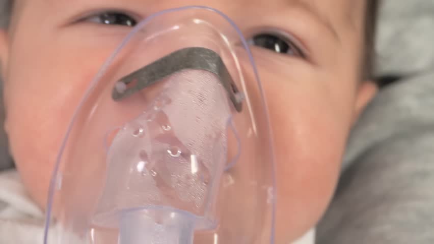 inhalation mask on a child's face close-up. Royalty-Free Stock Footage #1100798635