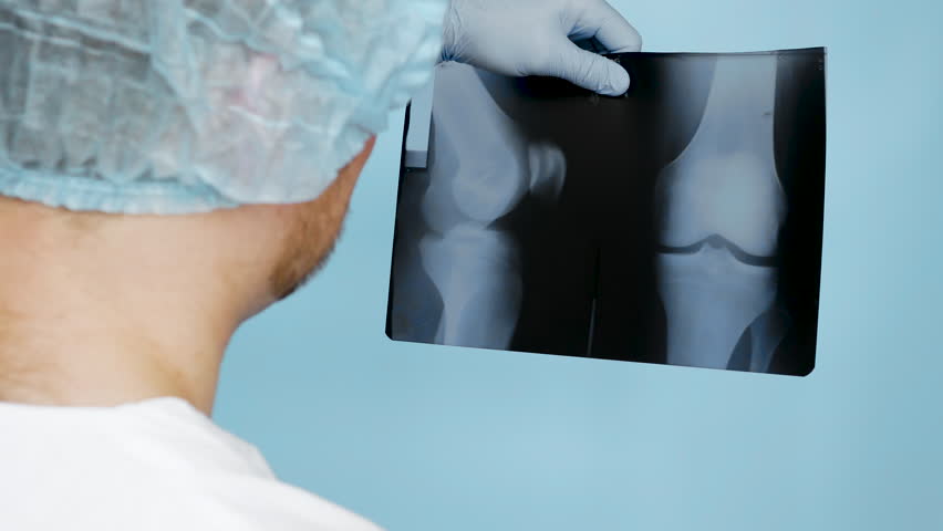 Doctor with knee x-ray. A doctor analyzes a man's knee injury on an ultrasound scan. Medical worker in a hospital with an x-ray in hand. Royalty-Free Stock Footage #1100799431
