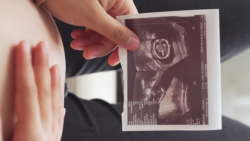Female holding ultrasound picture and rubbing her belly, close up view vertical Royalty-Free Stock Footage #1101247513