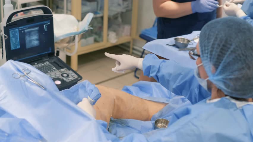 Doctors perform operations for varicose veins, leg swelling and twisted veins. Royalty-Free Stock Footage #1101824431