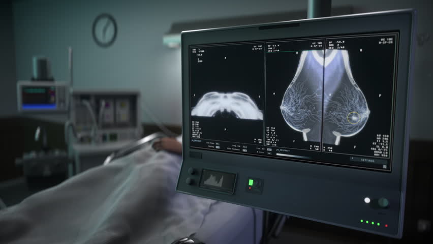 Diagnostic imaging technology scanning the chest of the sick hospital patient. Diagnostic imaging technology looking for diseases. Diagnostic imaging technology detecting cancer cells in breast. Royalty-Free Stock Footage #1102220425