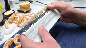 Close up of shade guide to check veneer of tooth crown in a dental laboratory. Dental technician holds the tool palette. High quality 4k slow motion video footage