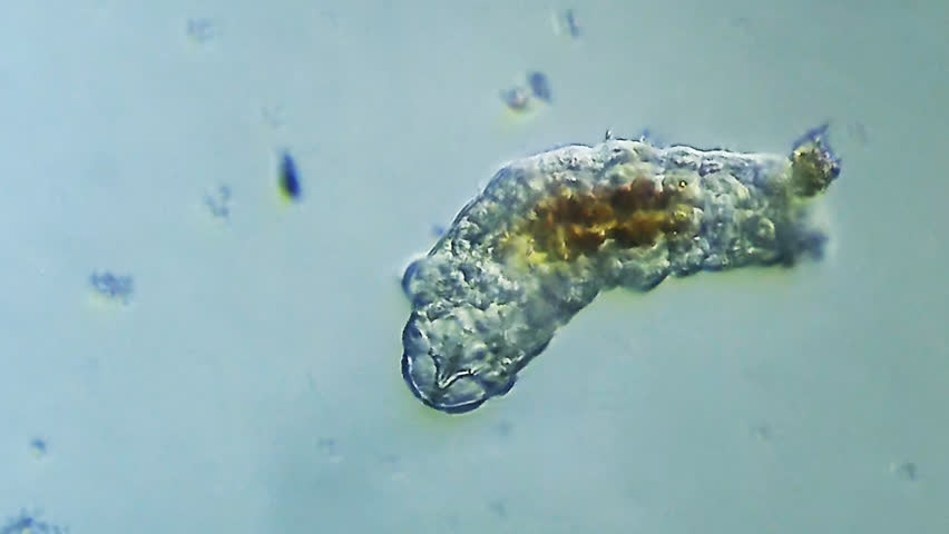 Tardigrade microorganism viewed under microscope