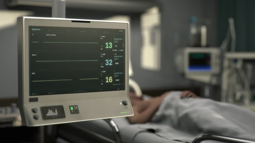 Modern Hospital Equipment Warns Patient Dying From Progressing Heart Disease. Patient In Emergency Condition Dying. Heart Rate Stop. Machine Monitoring Heartbeat Of Dying Patient. Clinic. ECG Royalty-Free Stock Footage #1102597461