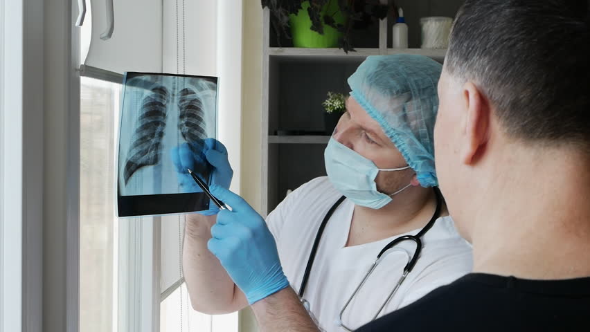 A doctor in an office with a sick patient, a radiographer examines an x-ray of the lungs of an elderly person in a hospital. The doctor diagnoses pneumonia. X-ray in the hands of a male doctor Royalty-Free Stock Footage #1102597975