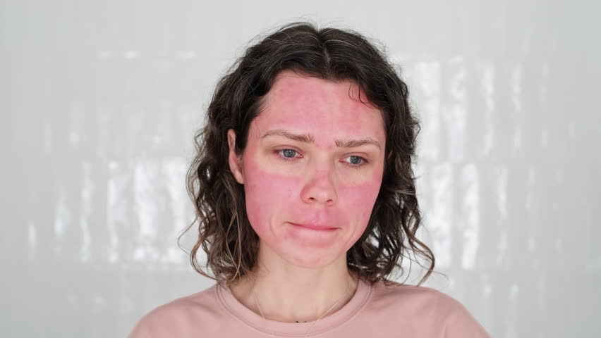 Young Woman Female Looking Disappointed  Examines Red Blotches on Face Resulting Unprofessional Skincare Treatment Failed Peel Allergic Reaction. Emotional Turmoil Caused by Appearance Imperfections Royalty-Free Stock Footage #1103399357