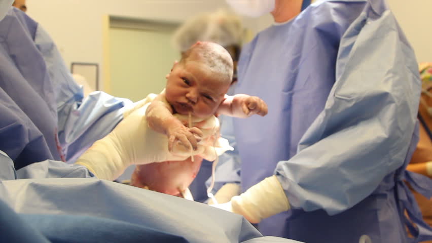 Baby being born by caesarean section. The excited mother observes the situation.The father is operating the camera caressing the mother. Royalty-Free Stock Footage #1103482091