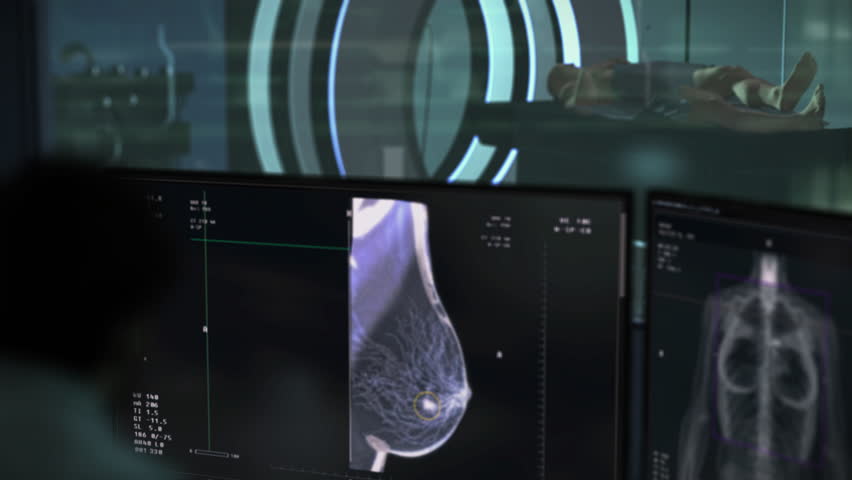 Performing the x-ray screening test on the sick patients chest. Mammography X-ray screening test examining the female breast. X-ray screening test diagnosing the dangerous cancer cells in the breast. Royalty-Free Stock Footage #1103524105