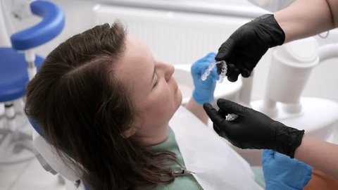 dentist applying invisible aligner on a female patient's teeth at a modern clinic, with the concept of teeth correcting  库存视频