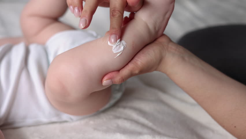mother hand using cream from jar to apply on baby new born infant legs.child with eczema or dermatitis red spots on foot. rash or kid allergy on body.woman hand massaging putting cream on dry skin 4k  Royalty-Free Stock Footage #1103568423