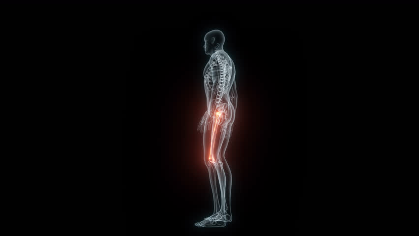 3D Rendering of a Medical Animation of the Femur. X-ray of the Femur. | Shutterstock HD Video #1103652891