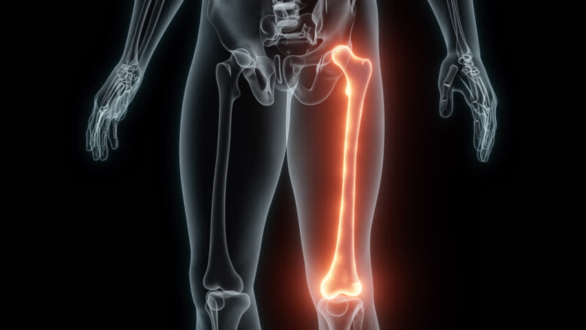 3D Rendering of a Medical Animation of the Femur. X-ray of the Femur. | Shutterstock HD Video #1103652899