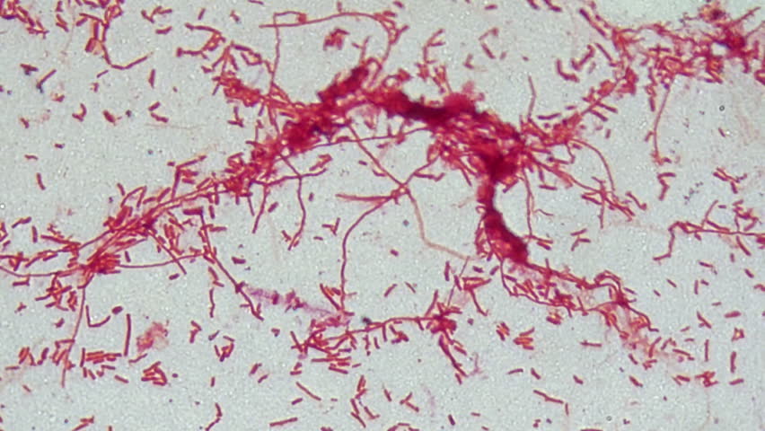 Bacteria cells under a microscope, bacteria magnified 1000 times.
