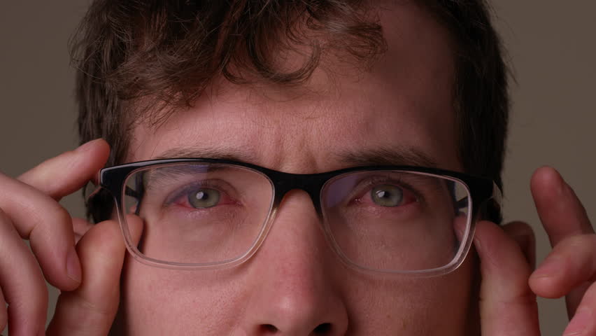 Man takes off glasses to reveal pink eye - close up on face Royalty-Free Stock Footage #1103863003