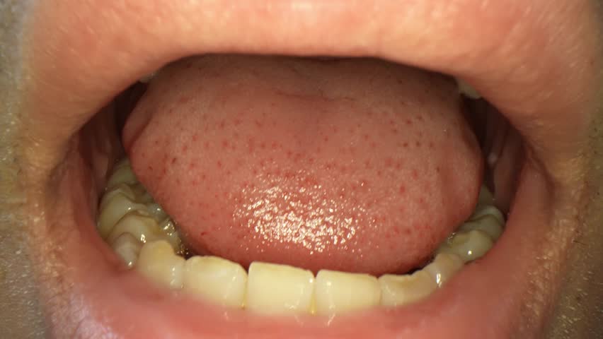 Asian oral macro video offers a magnified view of the oral cavity, focusing on the mouth, teeth, gums, and tongue in individuals of Asian descent. It helps diagnose dental issues, assess oral hygiene
