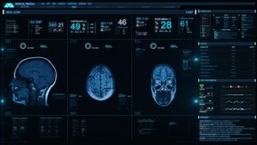 Medical Profile of Patient Showing Head and Brain MRI Scan. Vital Signs and Several Healthcare Information. Futuristic Technological Interface Analyzing Human Anatomy. - Powered by Shutterstock - Get 15% off with code: PIKWIZARD15